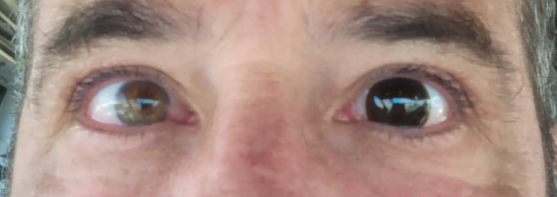 Altius Contacts – FoilSurfing.Net